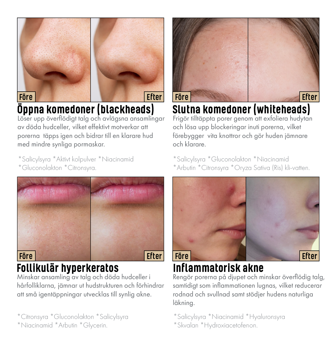 Dr.Melaxin™ - Pore Refining Rice Serum