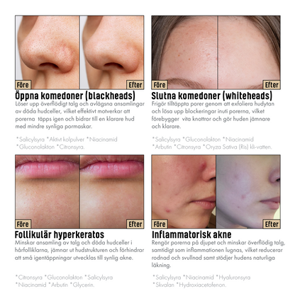 Dr.Melaxin™ - Pore Refining Rice Serum